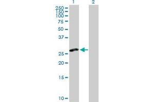 Western Blot analysis of CLEC2D expression in transfected 293T cell line by CLEC2D MaxPab polyclonal antibody. (CLEC2D 抗体  (AA 1-191))