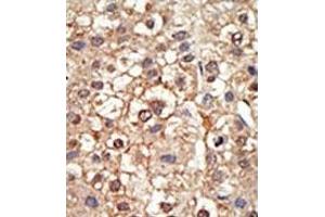 Image no. 2 for anti-Protein Inhibitor of Activated STAT, 4 (PIAS4) (N-Term) antibody (ABIN356770) (PIAS4 抗体  (N-Term))