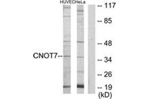 Western blot analysis of extracts from HeLa/HuvEc cells, using CNOT7 Antibody. (CNOT7 抗体  (AA 10-59))