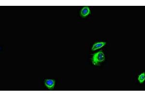 Immunofluorescent analysis of HepG2 cells using ABIN7144171 at dilution of 1:100 and Alexa Fluor 488-congugated AffiniPure Goat Anti-Rabbit IgG(H+L) (ANKS6 抗体  (AA 1-132))