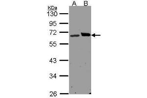 WB Image Sample(30 μg of whole cell lysate) A:H1299 B:Hep G2, 10% SDS PAGE antibody diluted at 1:1500 (RPN1 抗体  (C-Term))