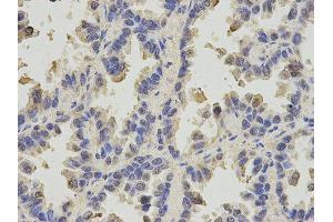 Immunohistochemistry (IHC) image for anti-Solute Carrier Family 4, Sodium Bicarbonate Cotransporter, Member 4 (SLC4A4) antibody (ABIN1876520) (SLC4A4 抗体)