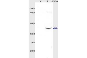 Lane 1: rat brain lysates Lane 2: mouse intestine lysates probed with Anti SRG4/TSARG4 Polyclonal Antibody, Unconjugated  at 1:3000 90min in 37˚C. (SUN5 抗体  (AA 161-275))