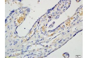 Immunohistochemistry (IHC) image for anti-PCNA Clamp Associated Factor (PAF) antibody (ABIN737931)