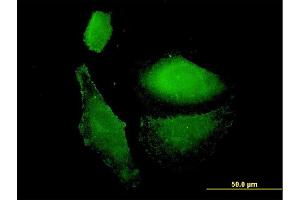 Immunofluorescence of monoclonal antibody to VAMP1 on HepG2 cell. (VAMP1 抗体  (AA 28-96))