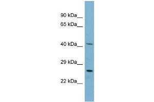 WB Suggested Anti-MRPS2 Antibody Titration: 0. (MRPS2 抗体  (N-Term))