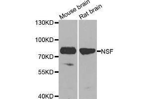 Western blot analysis of extracts of various cell lines, using NSF antibody. (NSF 抗体)
