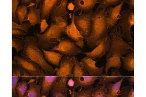 Immunofluorescence analysis of U-2OS cells using Caspase-3 Polyclonal Antibody at dilution of 1:100. (Caspase 3 抗体)