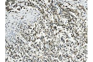 IHC analysis of Transketolase/TKT using anti-Transketolase/TKT antibody (ABIN7598957).