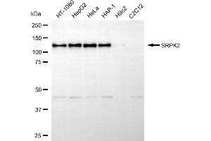 Western blotting analysis using SRPK2 antibody (ABIN7800327). (SRPK2 抗体)