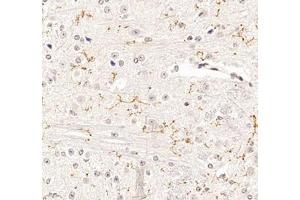 Immunohistochemistry of paraffin embedded mouse spinal cord using P2Y12 (ABIN7075321) at dilution of 1: 1400 (400x lens) (P2RY12 抗体)