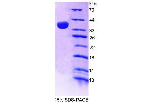 SDS-PAGE analysis of Mouse GBP4 Protein. (GBP4 蛋白)