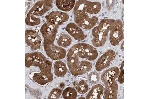 Immunohistochemical staining of human kidney with C9orf97 polyclonal antibody  shows strong cytoplasmic and nuclear positivity in proximal tubules at 1:50-1:200 dilution. (TSTD2 抗体)