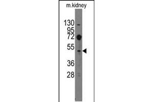 Western blot analysis of anti-Evx2 Pab in mouse kidney tissue lysates (35ug/lane) (EVX2 抗体  (C-Term))