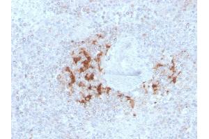 Formalin-fixed, paraffin-embedded human Spleen stained with TRAF1 Mouse Monoclonal Antibody (TRAF1/3298). (TRAF1 抗体  (AA 73-219))