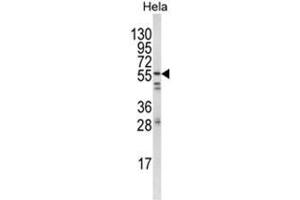 Western blot analysis of FYN Antibody (N-term) in Hela cell line lysates (35ug/lane). (FYN 抗体  (N-Term))