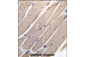 Formalin-fixed and paraffin-embedded human skeletal muscle tissue reacted with MAP2K4 polyclonal antibody  , which was peroxidase-conjugated to the secondary antibody, followed by DAB staining. (MAP2K4 抗体  (Ser257))
