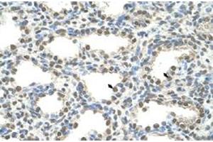 Immunohistochemical staining (Formalin-fixed paraffin-embedded sections) of human lung with FOXQ1 polyclonal antibody  at 4-8 ug/mL working concentration. (FOXQ1 抗体  (N-Term))