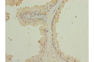 Immunohistochemistry (IHC) image for anti-Zinc Finger, C3HC-Type Containing 13 (ZCCHC13) (AA 1-166) antibody (ABIN7176044)