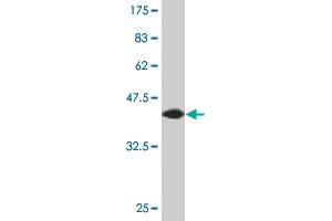 Western Blot detection against Immunogen (44. (AGR2 抗体  (AA 1-175))