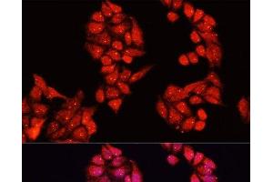 Immunofluorescence analysis of HeLa cells using ALDH9A1 Polyclonal Antibody at dilution of 1:100. (ALDH9A1 抗体)