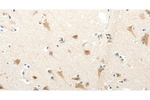Immunohistochemistry (Paraffin-embedded Sections) (IHC (p)) image for anti-Sema Domain, Immunoglobulin Domain (Ig), Short Basic Domain, Secreted, (Semaphorin) 3D (SEMA3D) antibody (ABIN7238357)