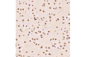 Immunohistochemistry (Paraffin-embedded Sections) (IHC (p)) image for anti-Nuclear Apoptosis Inducing Factor 1 (NAIF1) antibody (ABIN7074867)