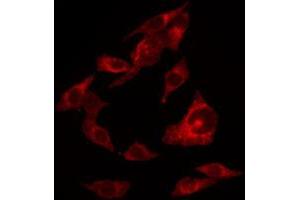 ABIN6267654 staining HuvEc by IF/ICC. (ERBB4 抗体  (pTyr1284))
