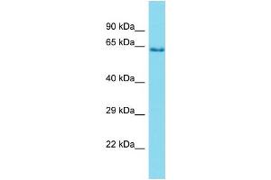 Western Blotting (WB) image for anti-Protease, Serine, 56 (PRSS56) (C-Term) antibody (ABIN2791462) (PRSS56 抗体  (C-Term))