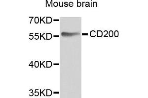 Western blot analysis of extracts of mouse brain, using CD200 antibody. (CD200 抗体)