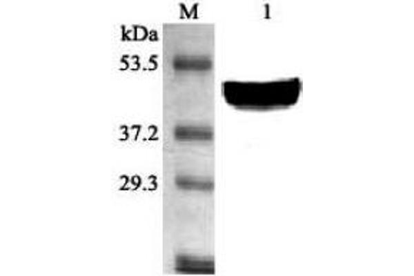 Stearoyl-Coenzyme A Desaturase 1 (SCD1) (AA 21-33) Antikörper