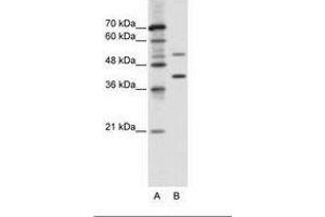 Image no. 1 for anti-REX4, RNA Exonuclease 4 Homolog (REXO4) (AA 270-319) antibody (ABIN6736107) (REXO4 抗体  (AA 270-319))