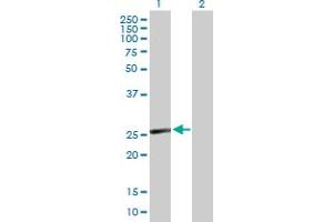 Western Blot analysis of CD8B expression in transfected 293T cell line by CD8B MaxPab polyclonal antibody. (CD8B 抗体  (AA 1-243))