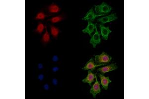 CNOT8 Antibody staining HepG2 cells by IF/ICC.