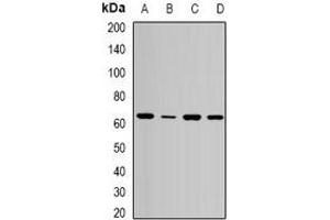 Western blot analysis of SPE39 expression in MCF7 (A), HepG2 (B), mouse liver (C), mouse kidney (D) whole cell lysates. (VIPAR 抗体)