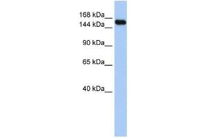 WB Suggested Anti-UBE3A  Antibody Titration: 0. (ube3a 抗体  (Middle Region))
