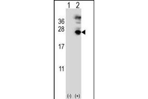 Western blot analysis of MF (arrow) using rabbit polyclonal MF Antibody (C-term) (ABIN391487 and ABIN2841455). (MFAP5 抗体  (C-Term))