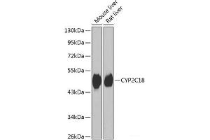 Western blot analysis of extracts of various cell lines using CYP2C18 Polyclonal Antibody at dilution of 1:1000. (CYP2C18 抗体)