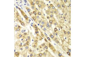 Immunohistochemistry (IHC) image for anti-C-terminal Binding Protein 1 (CTBP1) (AA 20-250) antibody (ABIN3022422) (CTBP1 抗体  (AA 20-250))