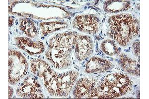 Immunohistochemical staining of paraffin-embedded Human Kidney tissue using anti-CAMLG mouse monoclonal antibody. (CAMLG 抗体)