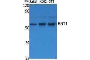 Western Blotting (WB) image for anti-Solute Carrier Family 29 (Nucleoside Transporters), Member 1 (SLC29A1) (N-Term) antibody (ABIN3187600) (SLC29A1 抗体  (N-Term))
