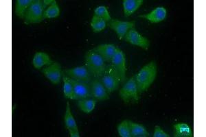 Immunofluorescence staining of Hela cells with ABIN7139823 at 1:166, counter-stained with DAPI. (EIF4G3 抗体  (AA 158-176))