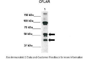 Western Blotting (WB) image for anti-CASP8 and FADD-Like Apoptosis Regulator (CFLAR) (N-Term) antibody (ABIN2792098)