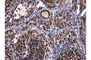 Immunohistochemistry (IHC) image for anti-DEAD (Asp-Glu-Ala-Asp) Box Polypeptide 39B (DDX39B) antibody (ABIN2855057)