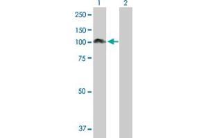 Western Blot analysis of PDCD6IP expression in transfected 293T cell line by PDCD6IP MaxPab polyclonal antibody. (ALIX 抗体  (AA 1-868))