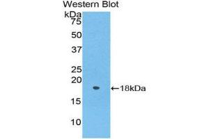 Western Blotting (WB) image for anti-Periostin (POSTN) (AA 24-173) antibody (ABIN1176623) (Periostin 抗体  (AA 24-173))