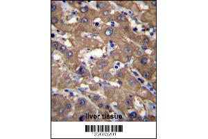 UGDH Antibody immunohistochemistry analysis in formalin fixed and paraffin embedded human liver tissue followed by peroxidase conjugation of the secondary antibody and DAB staining. (UGDH 抗体  (C-Term))