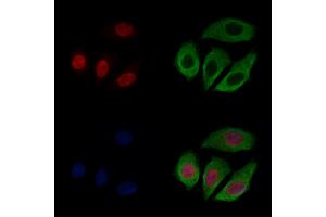 CASC5 Antibody staining Hela cells by IF/ICC. (CASC5 抗体  (Internal Region))
