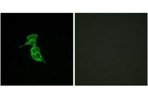 Immunofluorescence analysis of LOVO cells, using GPR143 Antibody. (GPR143 抗体  (AA 151-200))