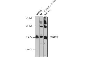 Western blot analysis of extracts of various cell lines, using SYNJ2BP antibody (ABIN7270667) at 1:1000 dilution. (SYNJ2BP 抗体  (AA 1-145))